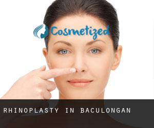 Rhinoplasty in Baculongan