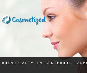 Rhinoplasty in Bentbrook Farms