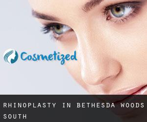 Rhinoplasty in Bethesda Woods South