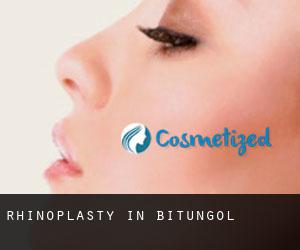 Rhinoplasty in Bituñgol