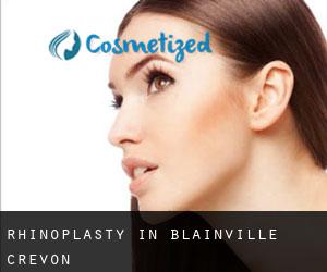 Rhinoplasty in Blainville-Crevon