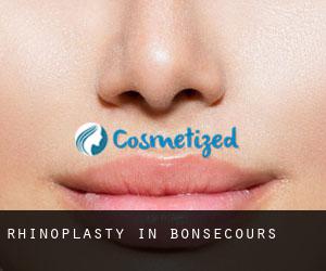 Rhinoplasty in Bonsecours