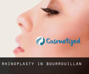 Rhinoplasty in Bourrouillan