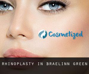 Rhinoplasty in Braelinn Green