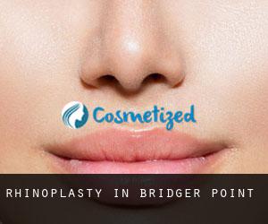 Rhinoplasty in Bridger Point