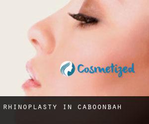 Rhinoplasty in Caboonbah