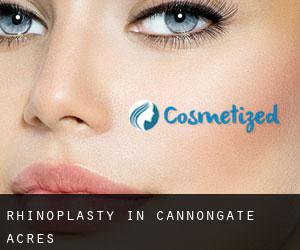 Rhinoplasty in Cannongate Acres