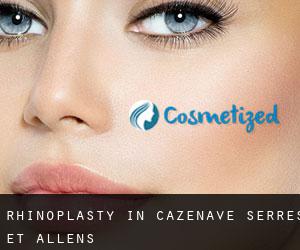 Rhinoplasty in Cazenave-Serres-et-Allens