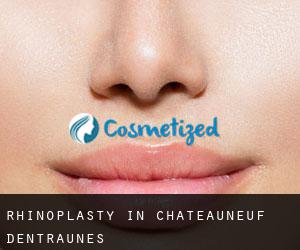 Rhinoplasty in Châteauneuf-d'Entraunes