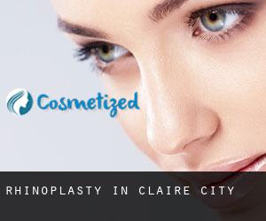Rhinoplasty in Claire City