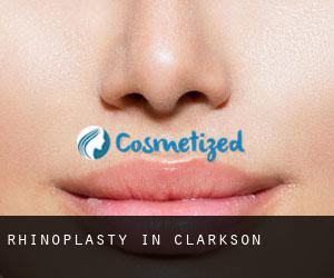 Rhinoplasty in Clarkson