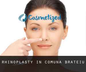 Rhinoplasty in Comuna Brateiu