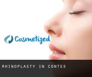 Rhinoplasty in Contes