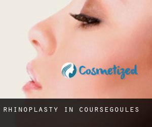 Rhinoplasty in Coursegoules