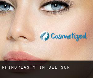 Rhinoplasty in Del Sur