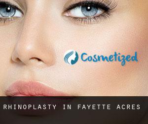 Rhinoplasty in Fayette Acres