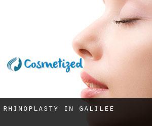 Rhinoplasty in Galilee