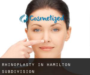 Rhinoplasty in Hamilton Subdivision