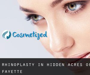 Rhinoplasty in Hidden Acres of Fayette