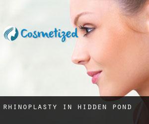 Rhinoplasty in Hidden Pond