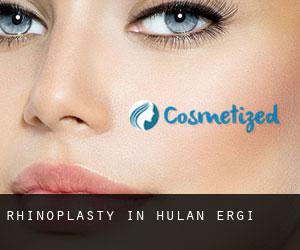 Rhinoplasty in Hulan Ergi