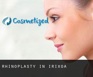 Rhinoplasty in Irixoa