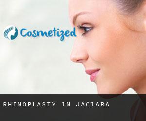 Rhinoplasty in Jaciara