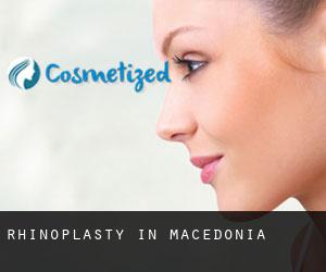 Rhinoplasty in Macedonia