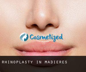 Rhinoplasty in Madières