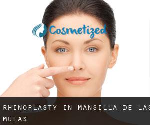 Rhinoplasty in Mansilla de las Mulas