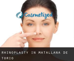 Rhinoplasty in Matallana de Torío