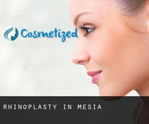 Rhinoplasty in Mesia