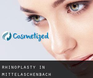 Rhinoplasty in Mittelaschenbach