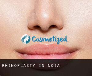 Rhinoplasty in Noia