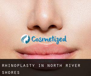 Rhinoplasty in North River Shores