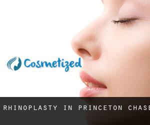 Rhinoplasty in Princeton Chase