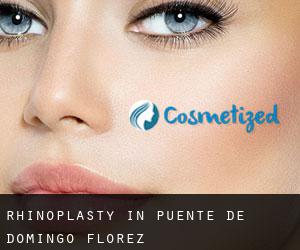 Rhinoplasty in Puente de Domingo Flórez