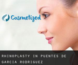 Rhinoplasty in Puentes de García Rodríguez