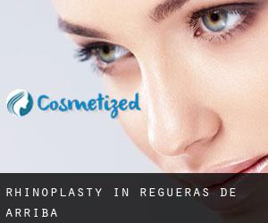 Rhinoplasty in Regueras de Arriba