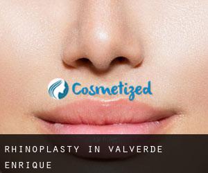 Rhinoplasty in Valverde-Enrique