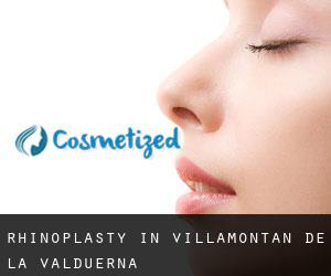 Rhinoplasty in Villamontán de la Valduerna