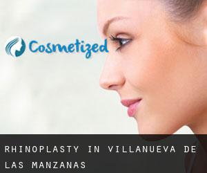 Rhinoplasty in Villanueva de las Manzanas