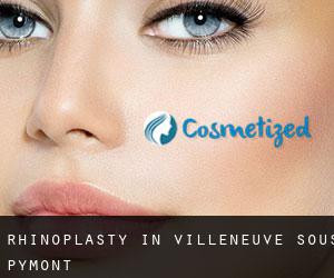 Rhinoplasty in Villeneuve-sous-Pymont