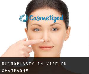 Rhinoplasty in Viré-en-Champagne