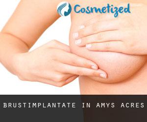 Brustimplantate in Amys Acres