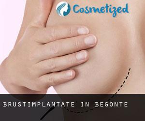 Brustimplantate in Begonte