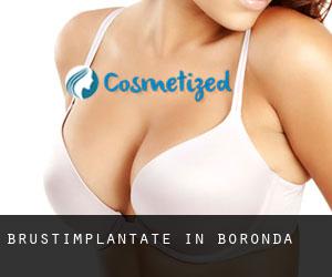 Brustimplantate in Boronda