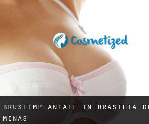 Brustimplantate in Brasília de Minas