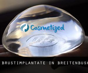 Brustimplantate in Breitenbush