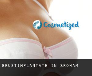 Brustimplantate in Broham